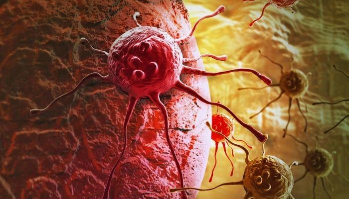 Ignorance will increase cancer deaths in Nigeria, Oncologist warns