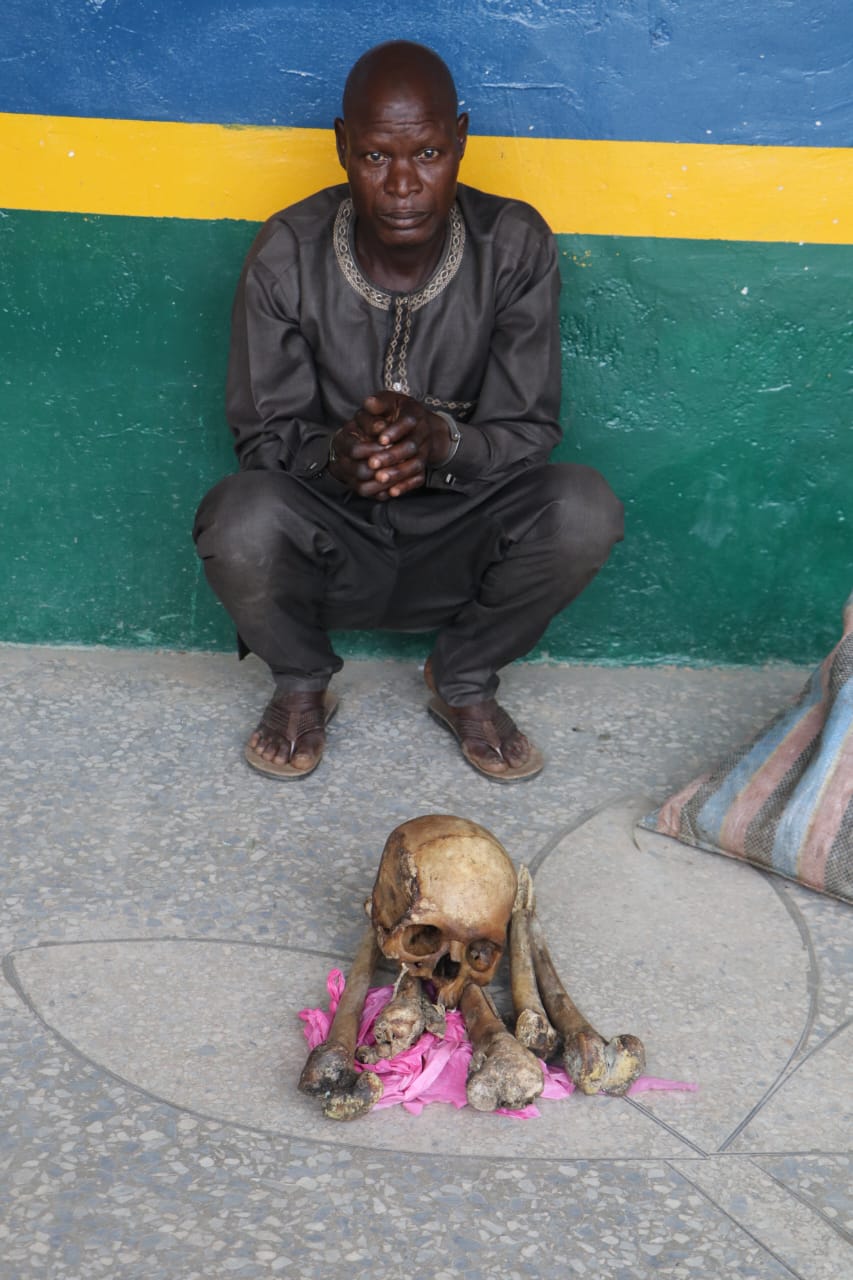 Police Arrest Man with Human Body Parts in Abuja 