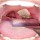 Jigawa records 91 suspected cases of diptheria, 10 deaths Diphtheria