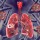 Delta partners media, others to deepen awareness on TB